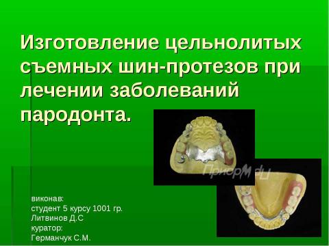 Презентация на тему "Изготовление цельнолитых съемных шин-протезов при лечении заболеваний пародонта" по медицине