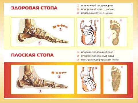 Презентация на тему "Ножки побежали по дорожке" по биологии