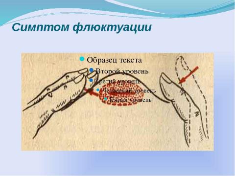 Презентация на тему "Гнойные заболевания кожи и подкожной клечатки" по медицине
