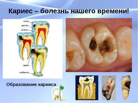 Презентация на тему "Чтобы зубы не болели" по биологии