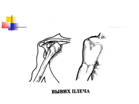 Презентация на тему "Общие вопросы хирургии повреждений Механическая травма. Вывихи. Переломы. Первая помощь, лечение" по медицине