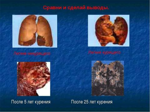 Презентация на тему "Классный час "Формула здоровья" для 3-4 класса" по биологии