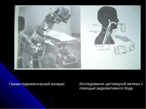 Презентация на тему "ПОЛУЧЕНИЕ РАДИОАКТИВНЫХ ИЗОТОПОВ И ИХ ПРИМЕНЕНИЕ" по физике