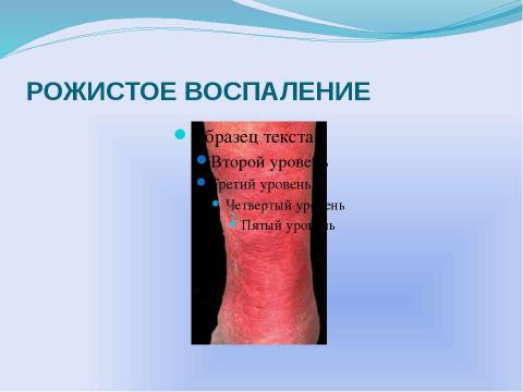 Презентация на тему "Гнойные заболевания кожи и подкожной клечатки" по медицине