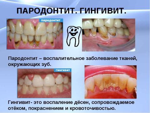 Презентация на тему "Чтобы зубы не болели" по биологии