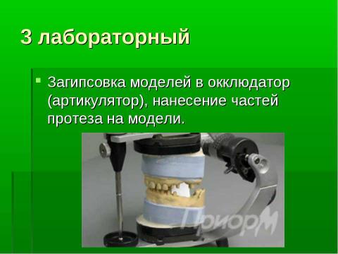 Презентация на тему "Изготовление цельнолитых съемных шин-протезов при лечении заболеваний пародонта" по медицине