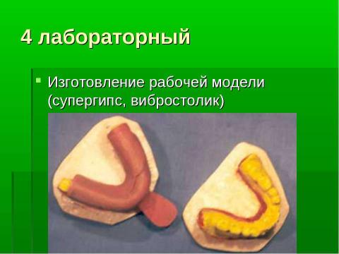 Презентация на тему "Изготовление цельнолитых съемных шин-протезов при лечении заболеваний пародонта" по медицине