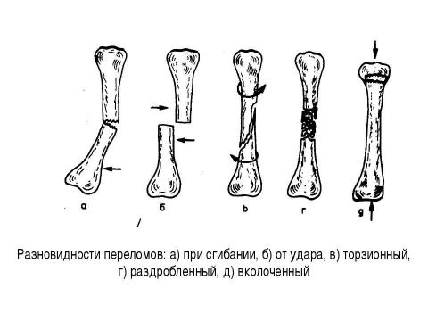 Презентация на тему "Общие вопросы хирургии повреждений Механическая травма. Вывихи. Переломы. Первая помощь, лечение" по медицине