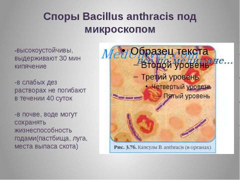 Презентация на тему "Сибирская язва" по медицине