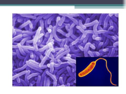Презентация на тему "Холера" по медицине