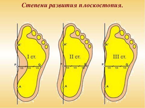 Презентация на тему "Ножки побежали по дорожке" по биологии