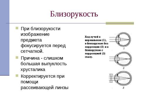 Презентация на тему "Глаз как оптическая система (8 класс)" по физике