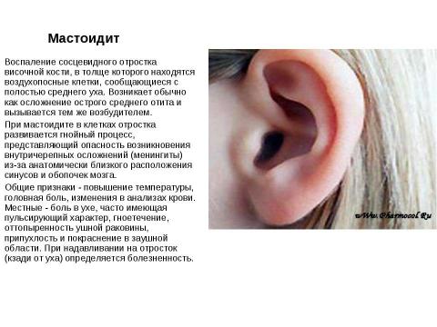 Презентация на тему "Ухо - это орган слуха" по биологии