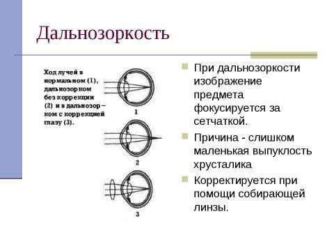 Презентация на тему "Глаз как оптическая система (8 класс)" по физике