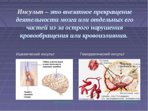 Презентация на тему "Первая доврачебная помощь при острой сердечной недостаточности и инсульте" по ОБЖ