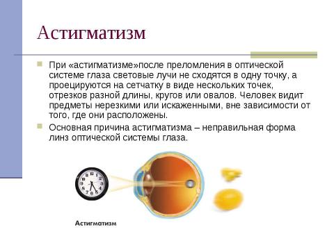 Презентация на тему "Глаз как оптическая система (8 класс)" по физике