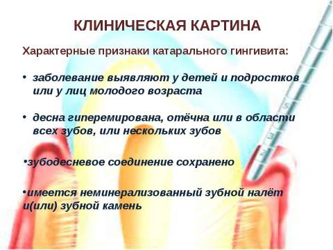 Презентация на тему "Генерализованный катаральный гингивит" по медицине