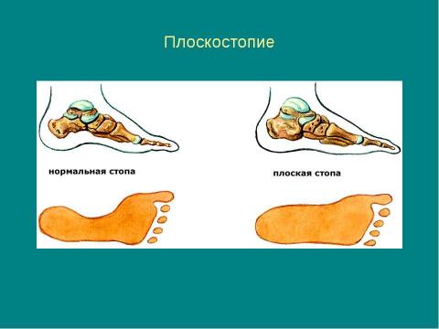 Презентация на тему "Значение физических упражнений для формирования скелета и мышц" по биологии