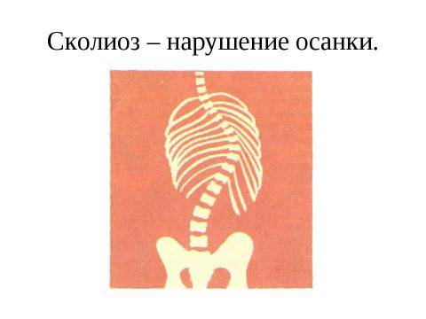 Презентация на тему "Сколько весит мое здоровье" по обществознанию