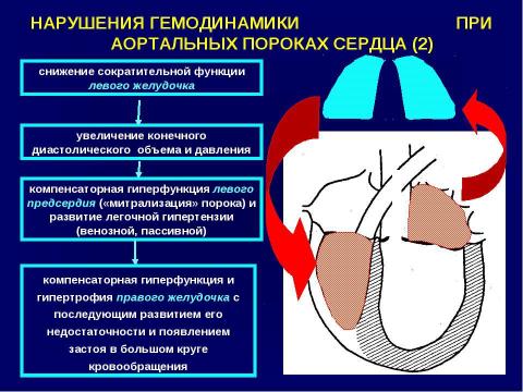 Презентация на тему "Аортальные пороки сердца" по медицине