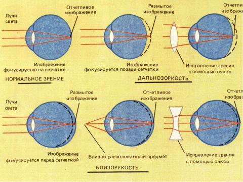 Презентация на тему "Почему портится зрение и можно ли его сохранить" по обществознанию