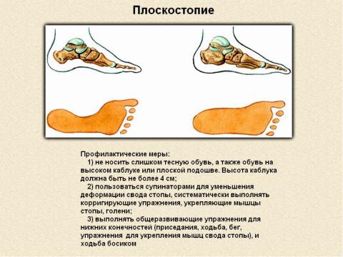 Презентация на тему "Значение физических упражнений для формирования скелета и мышц" по биологии