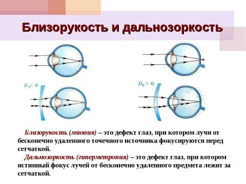 Презентация на тему "Из истории оптики, или Просто очки" по окружающему миру