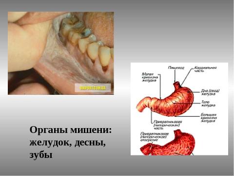 Презентация на тему "Курение. Его влияние на здоровье" по ОБЖ