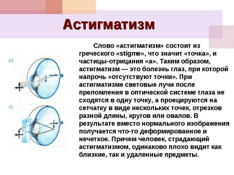 Презентация на тему "Из истории оптики, или Просто очки" по окружающему миру