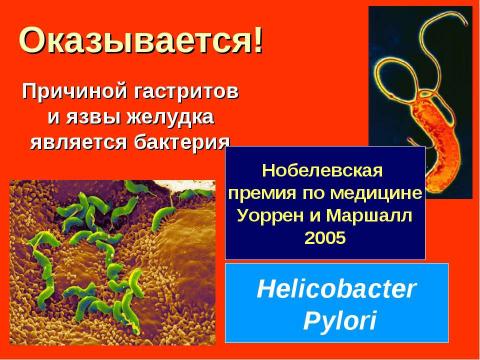 Презентация на тему "Пищеварительная система" по биологии